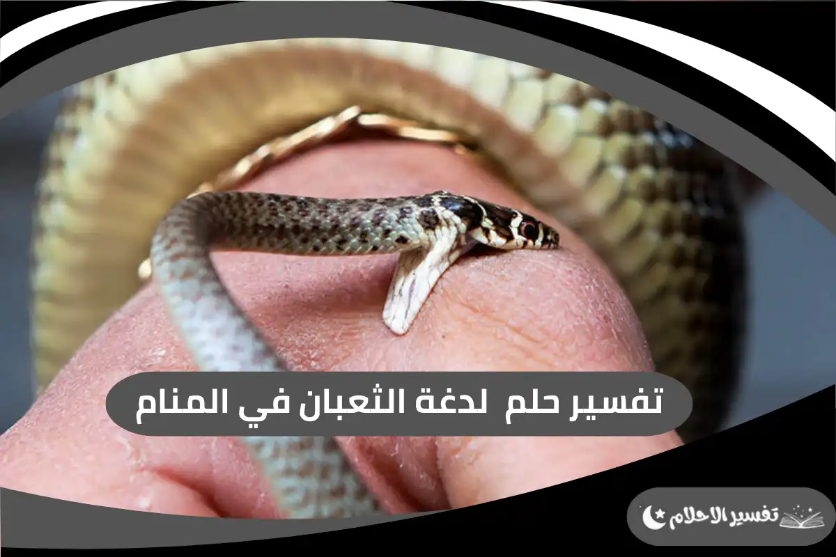 لدغة الثعبان في المنام